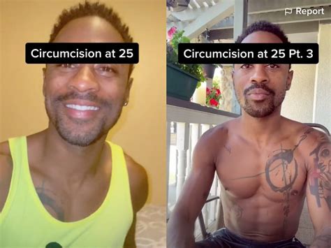 Phimosis – Circumcision Before and After